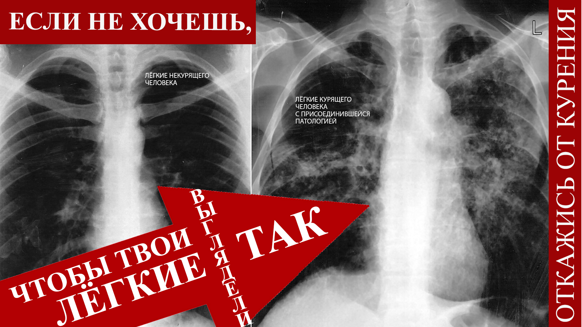 Plakat-k-dnyu-bez-tabaka - 0006